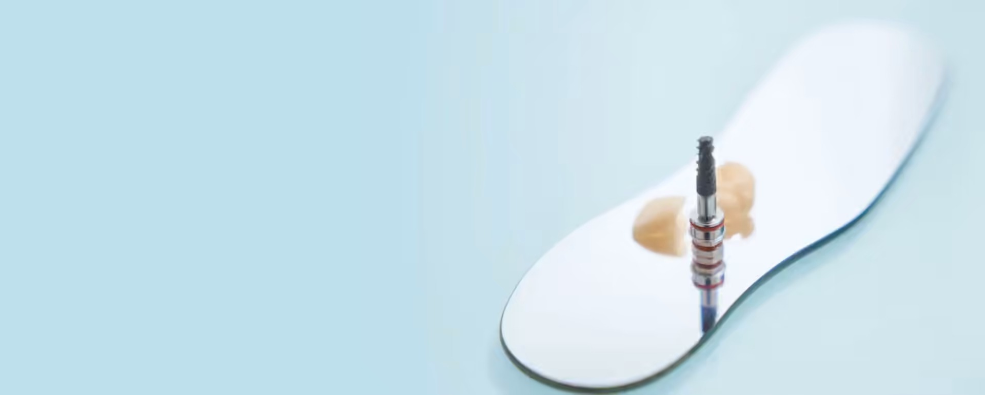 Which type of dental implant is best?