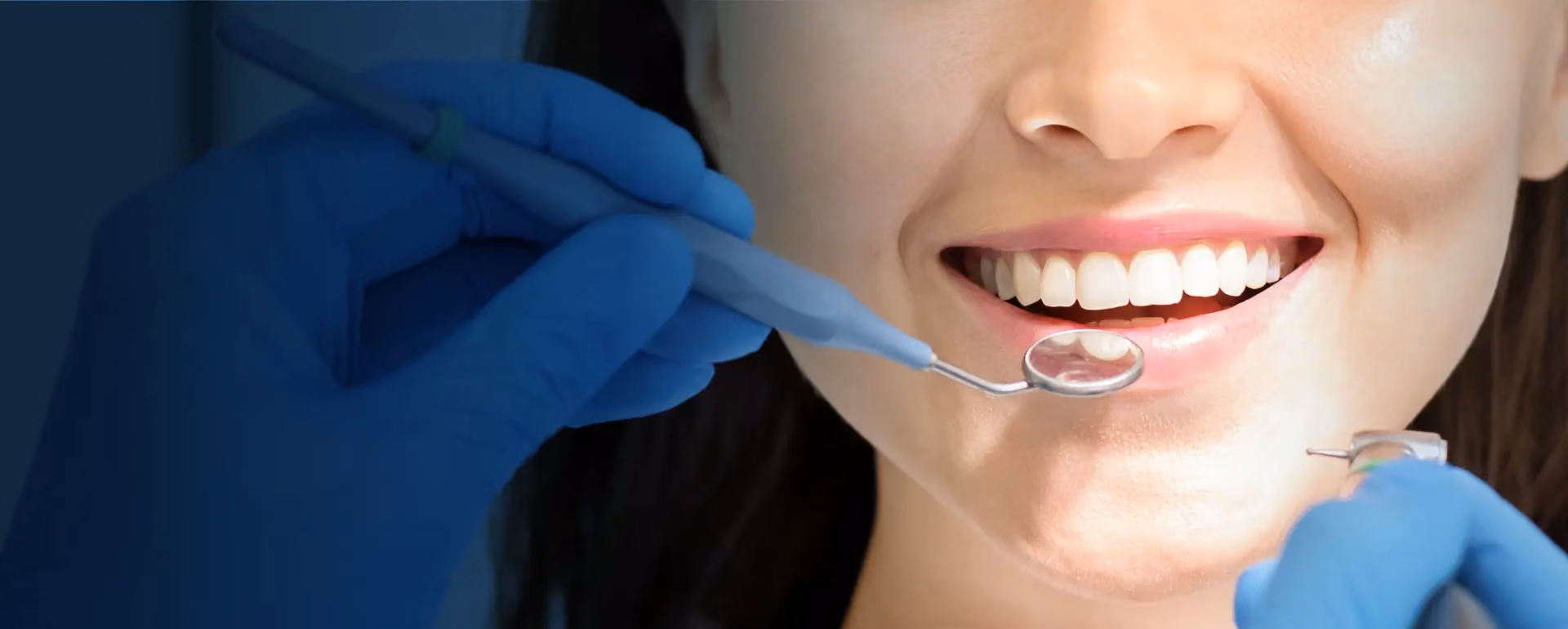 How much do veneers cost in 2026? Prices, materials and durability