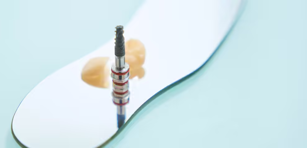 Are dental implants safe? Healing, contraindications and complications