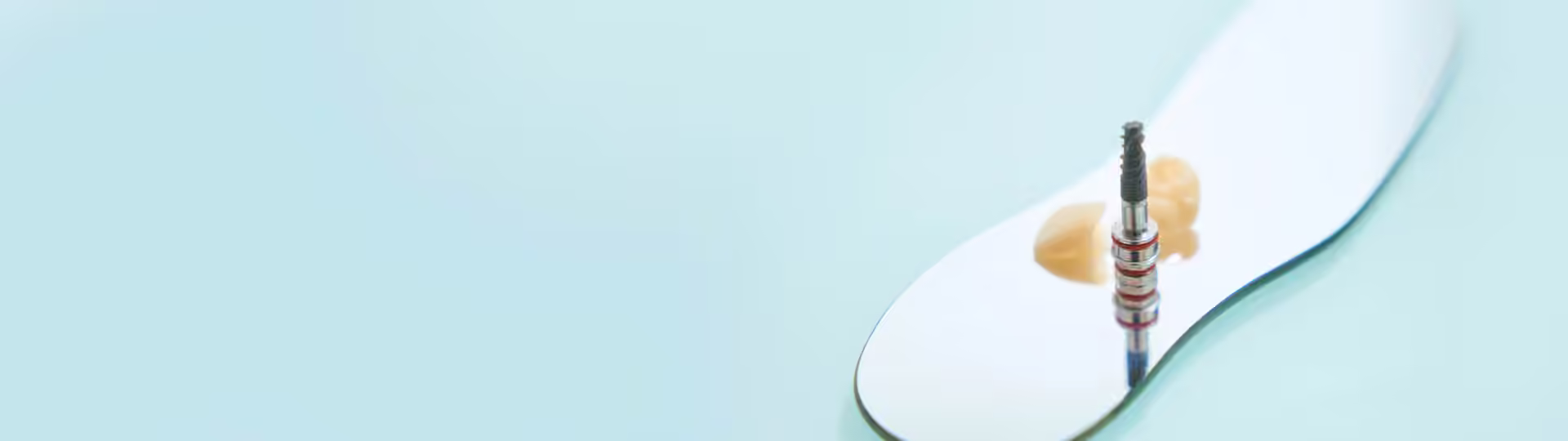 Can one implant support two teeth?