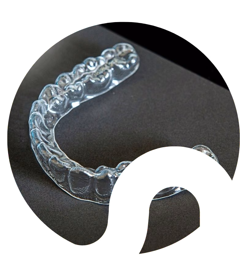 Clear orthodontic aligner