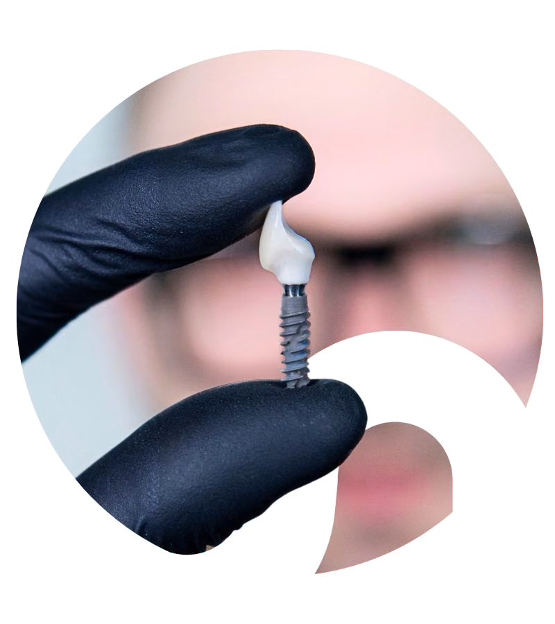 A dental implant in the hand of a Flow Dental Studio dentist