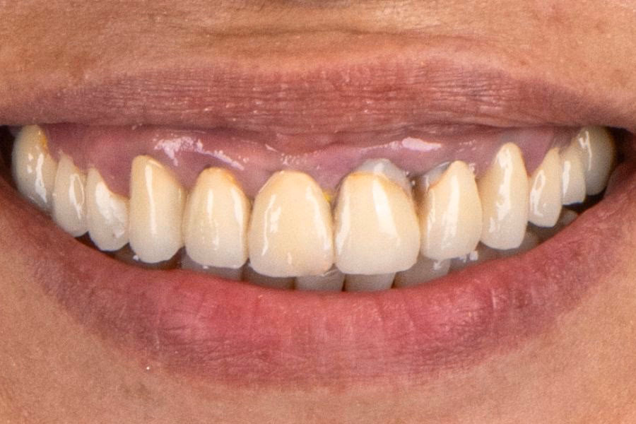 One dentist. One plan. A smile that looks like yours. - Flow Dental Studio Gdynia