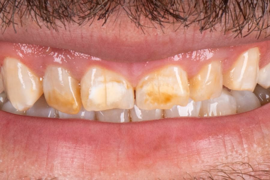 One dentist. One plan. A smile that looks like yours. - Flow Dental Studio Gdynia