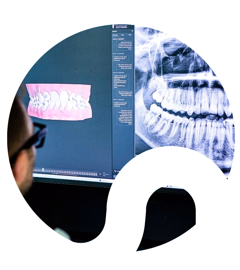 An X-ray image on screen at Flow Dental Studio