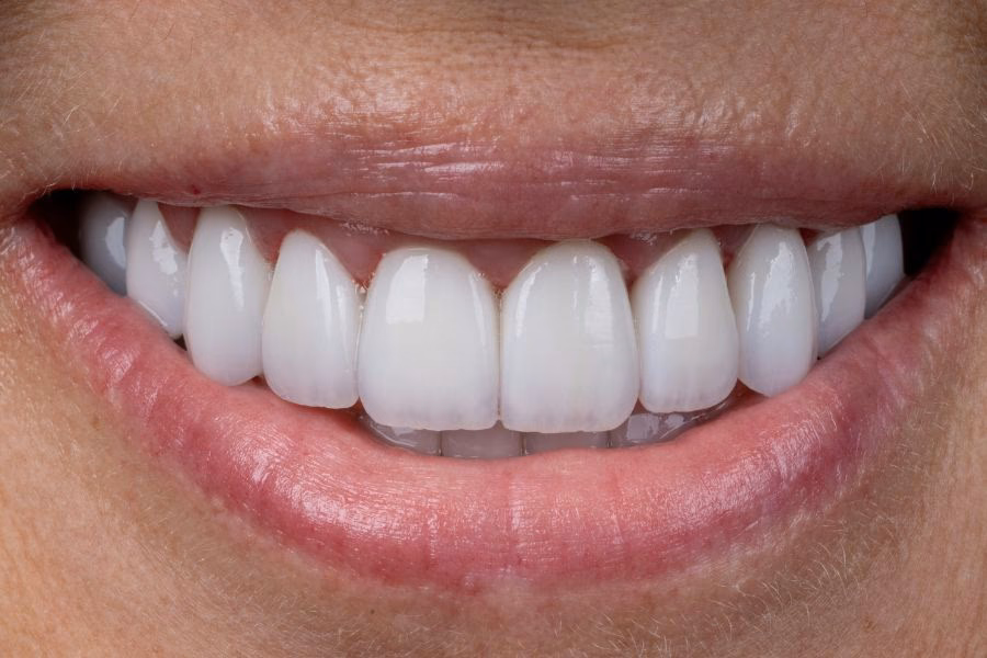 Digital smile design - Flow Dental Studio in Gdynia