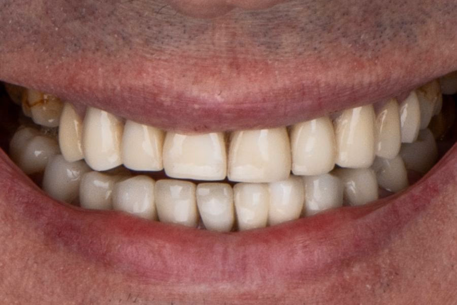 Before the smile makeover