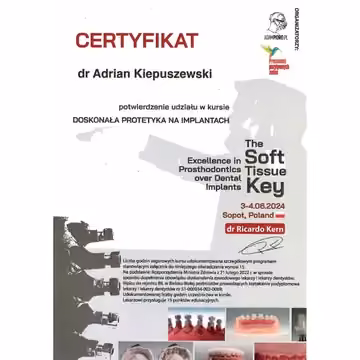 Excellent implant prosthetics – The Soft Tissue Key